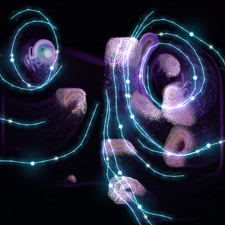 Soft Asterism